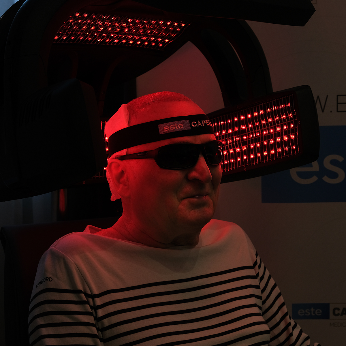 Saç Lazeri Tedavisi
