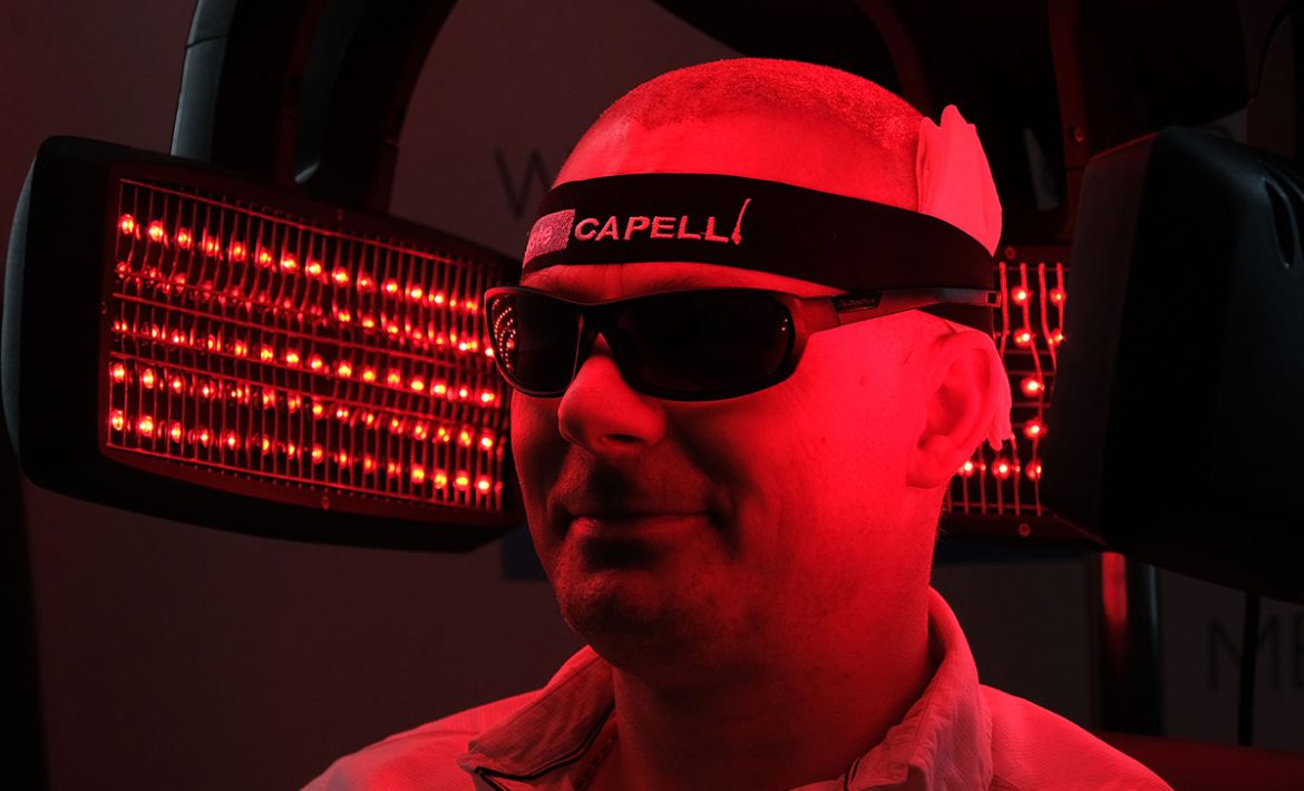 Lazer Tedavisi