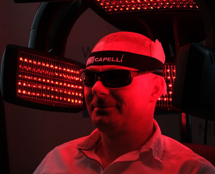 Lazer Tedavisi