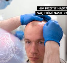 HIV Pozitif Hastalarda Saç Ekimi Nasıl Yapılır?
