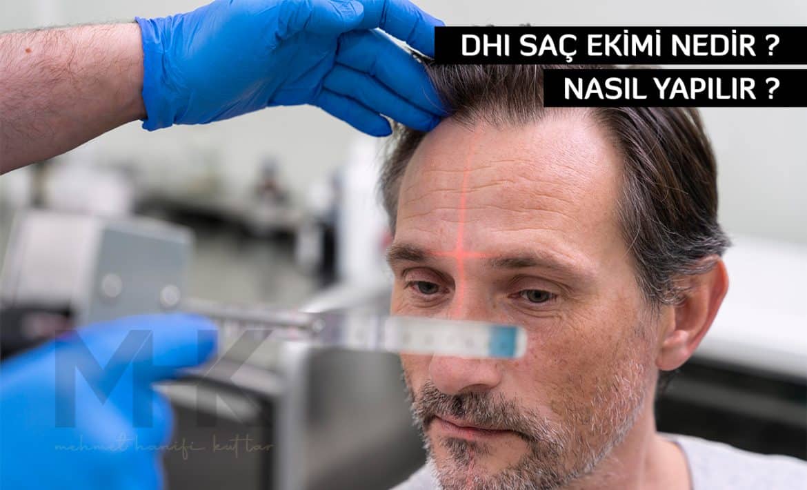 Dhi Saç Ekimi Nedir ? Nasıl Yapılır ?