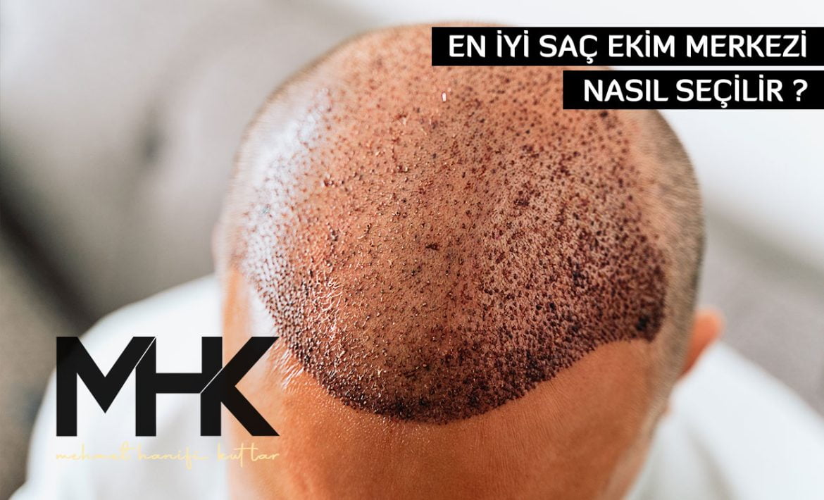 En İyi Saç Ekim Merkezi