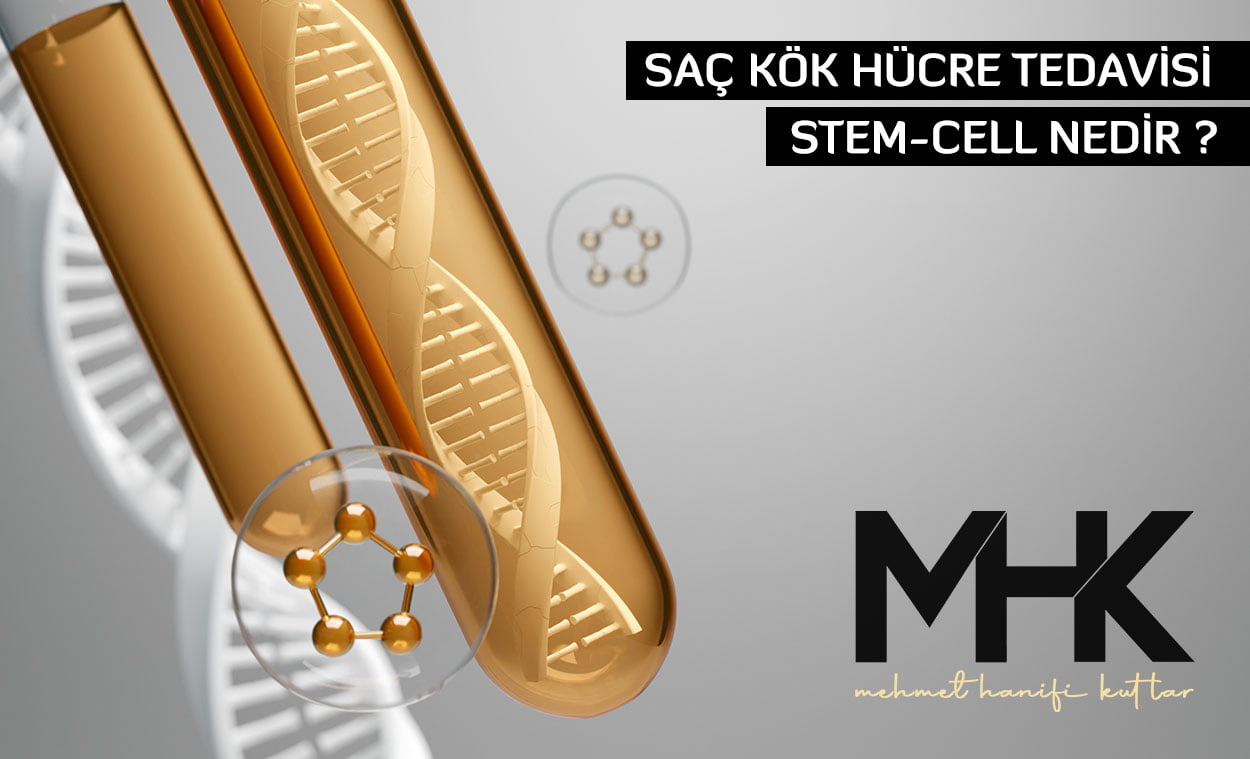 Saç Kök Hücre Tedavisi, Stem-cell