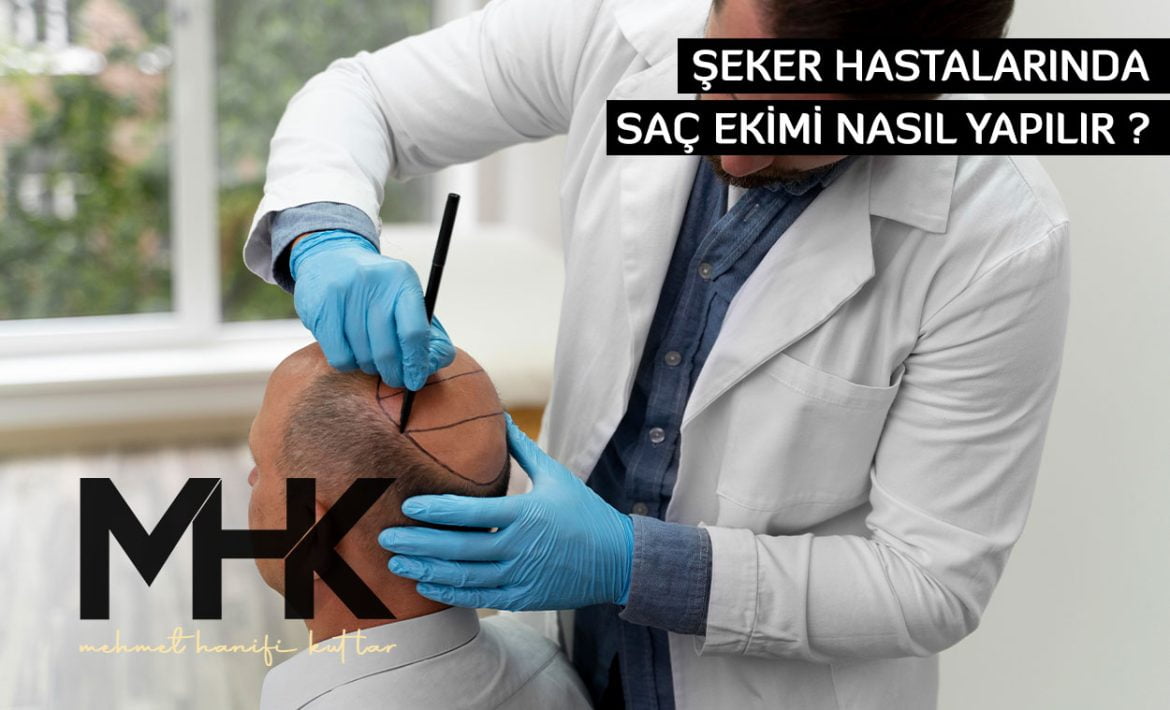 Şeker Hastalarında Saç Ekimi