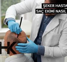 Şeker Hastalarında Saç Ekimi