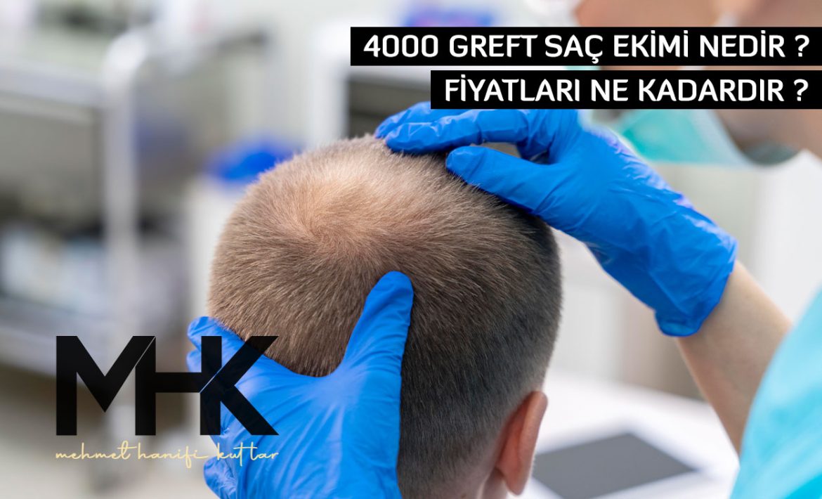 4000 Greft Saç Ekimi