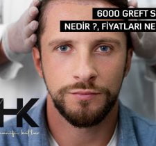 6000 Greft Saç Ekimi